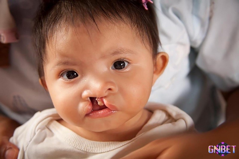 Mơ thấy sinh em bé bị tàn tật thể hiện cho những bất an và lo lắng trong cuộc sống của bạn